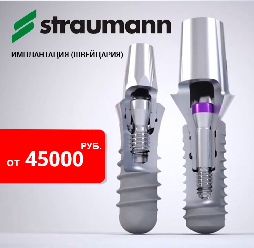 uslugi/implantacia-zubov/implant-straumann